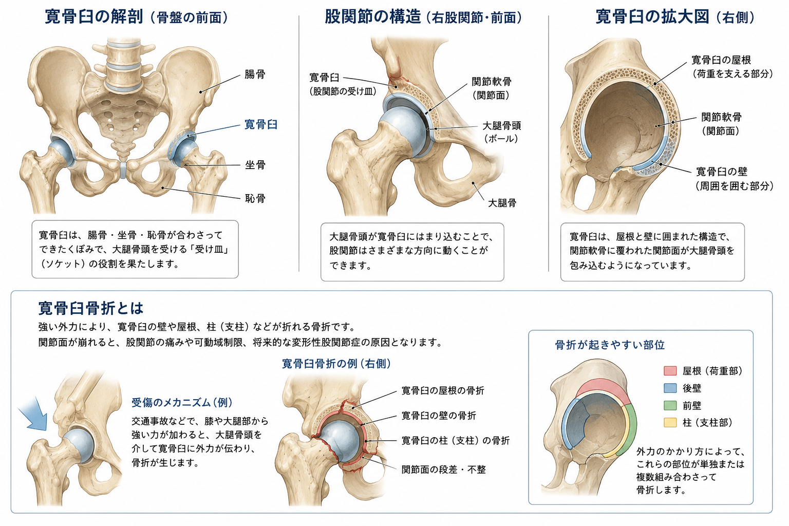 寛骨臼骨折の後遺障害-股関節の痛み・可動域制限は何級になる?-